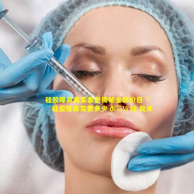 硅胶隆鼻真实案例揭秘全新价目「硅胶隆鼻需要多少 🐼 钱 我来告诉你」